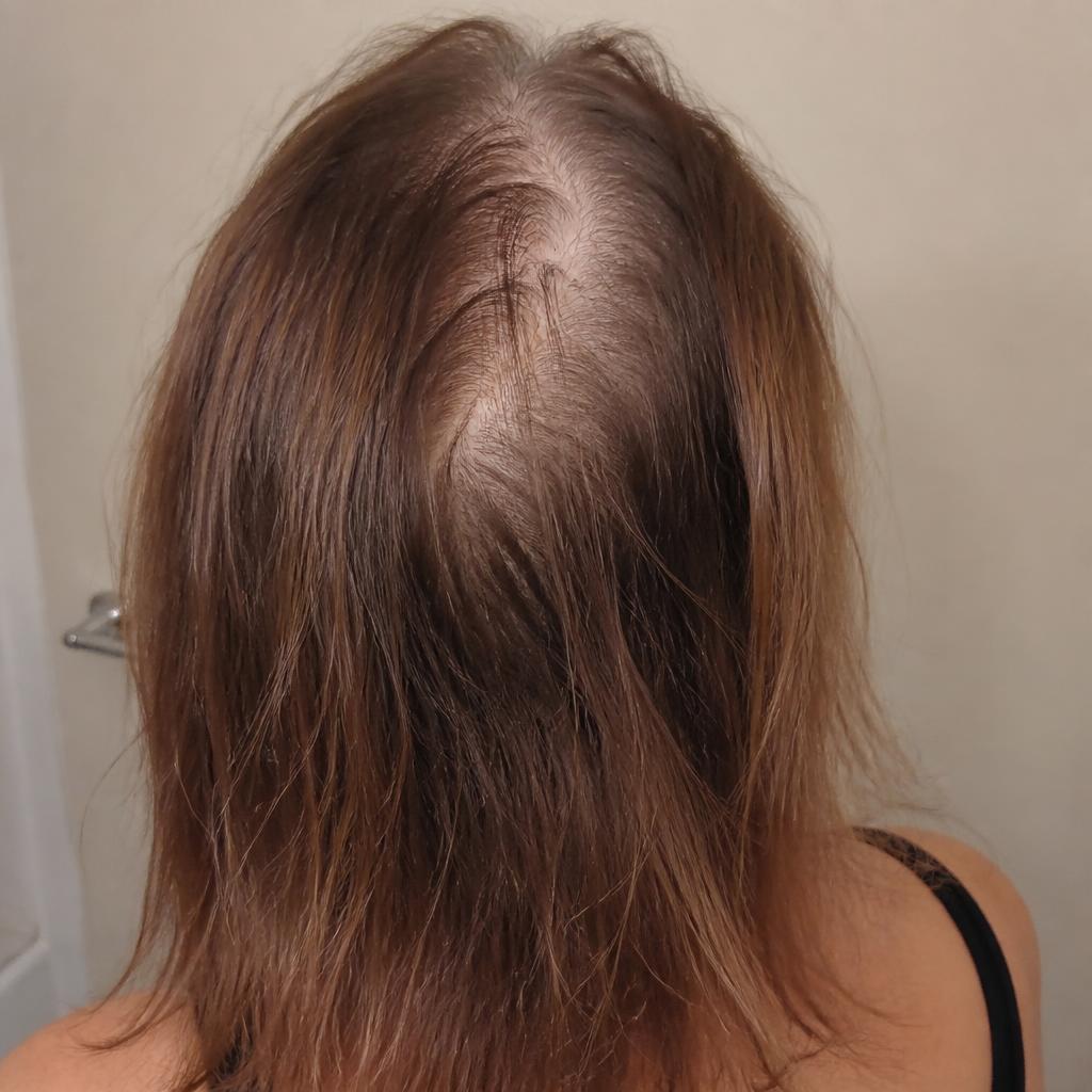 Thin hair with a wide part before use